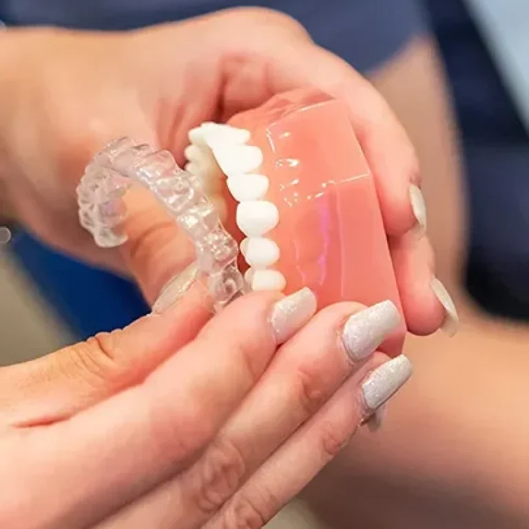 Clear Aligner Therapy